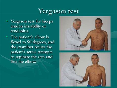 yergason test vs speed